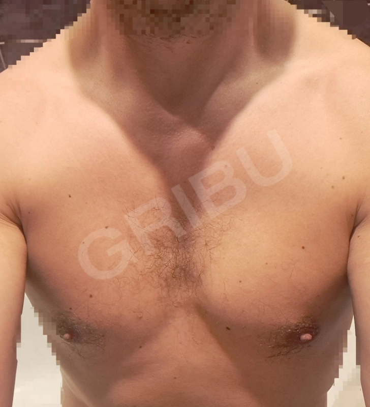Advertisement (8396012) - Andris 1
