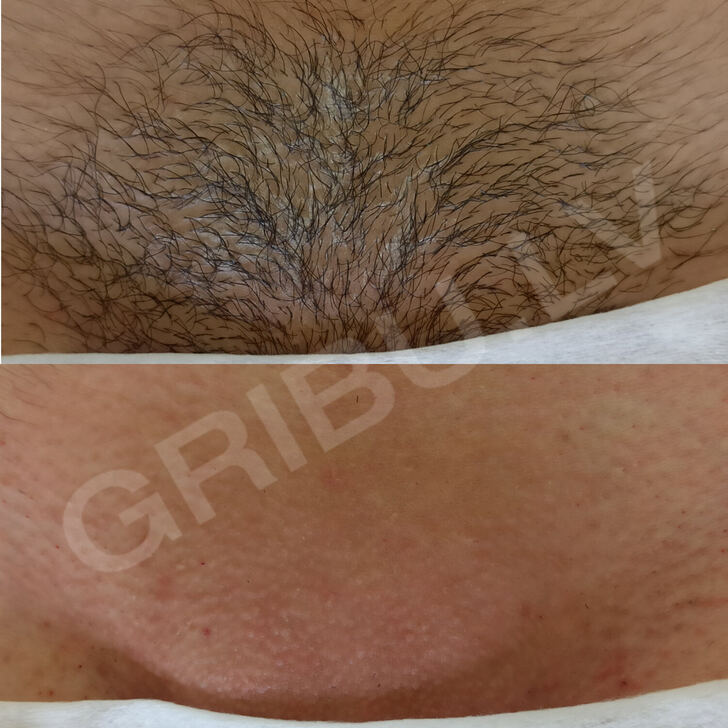 Erotiskā Masāža un Intim Pakalpojumi, Rīga. Afrodita: 29876392 5