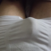 Burts