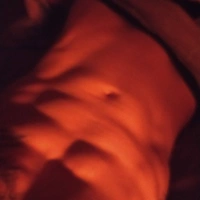 Macisso