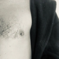 Skinq