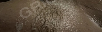 dyosis
